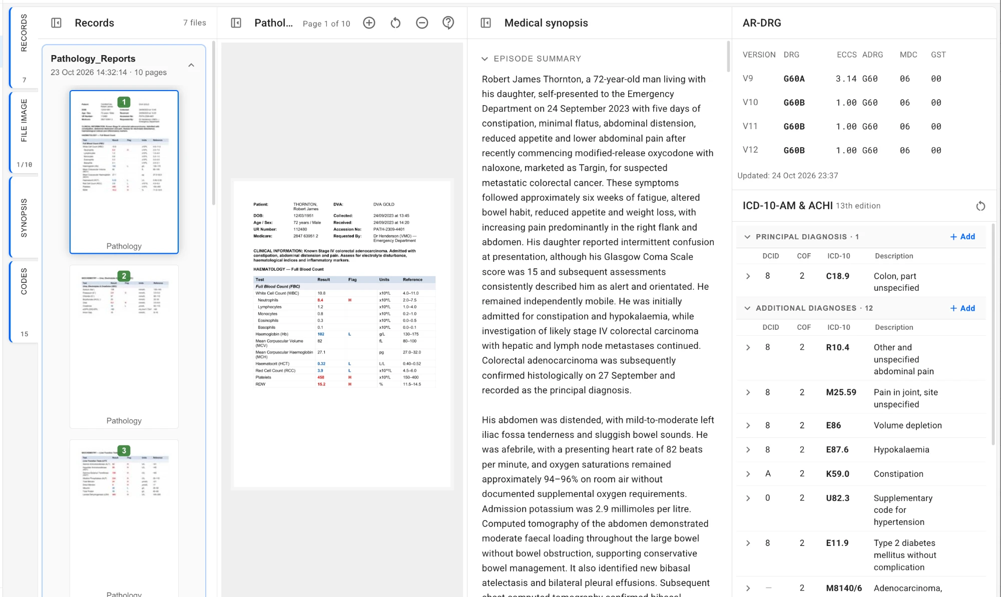 Coding review interface — recommendation, evidence, approve / edit / override